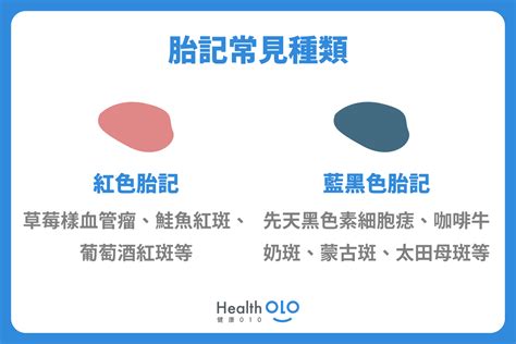 頭頂有胎記|胎記怎麼產生、何時消除？醫師剖析胎記種類、胎記寓意